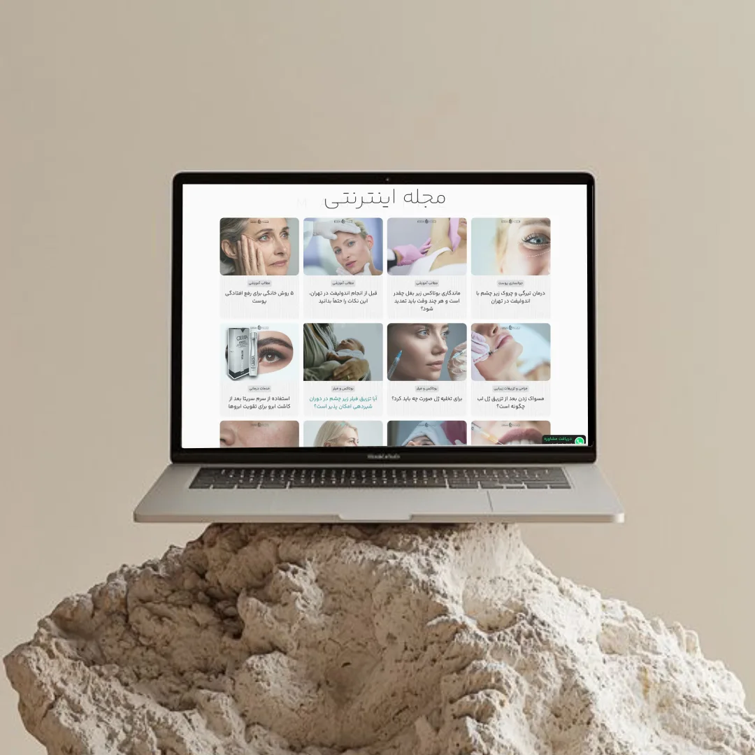 Designed based on the trendiest designs